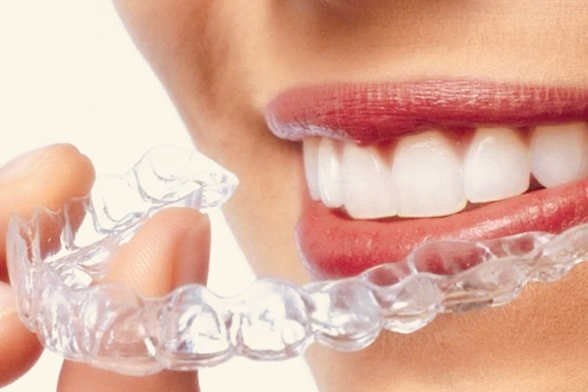 transparente Zahnschiene | Dr. med. dent. Jeannette Vaje - praxis für zahnheilkunde am ammersee - www.zahnheilkunde-am-ammersee.de
